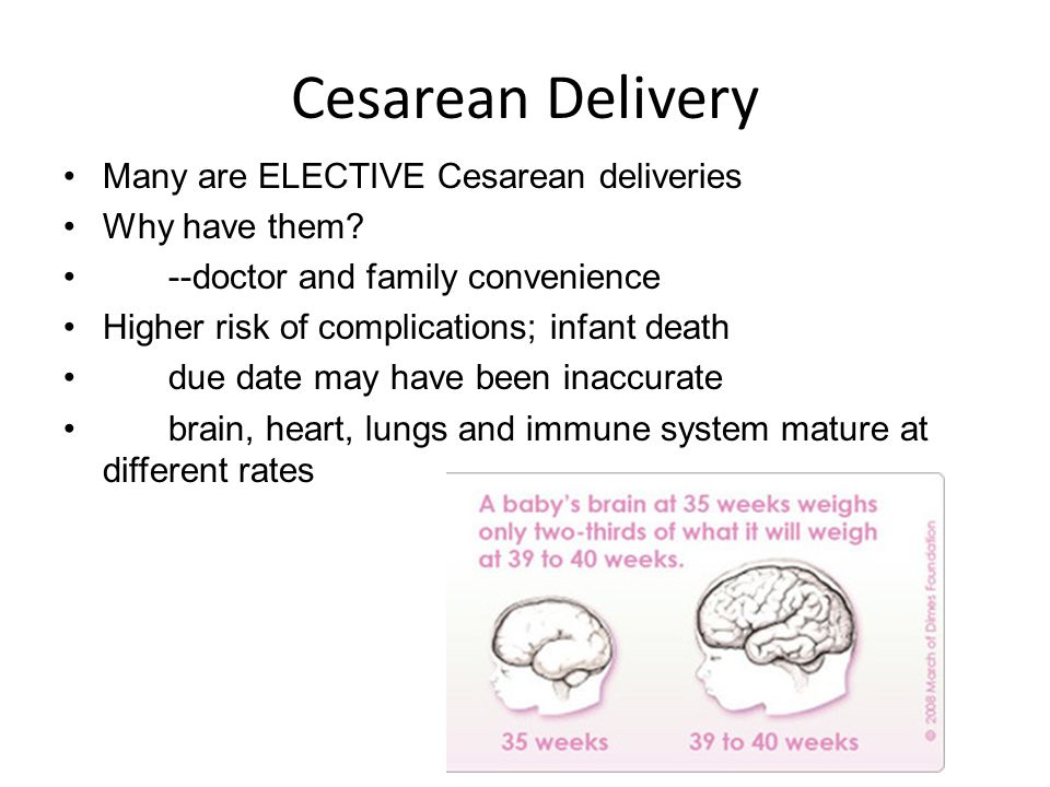 The elective cesarean delivery